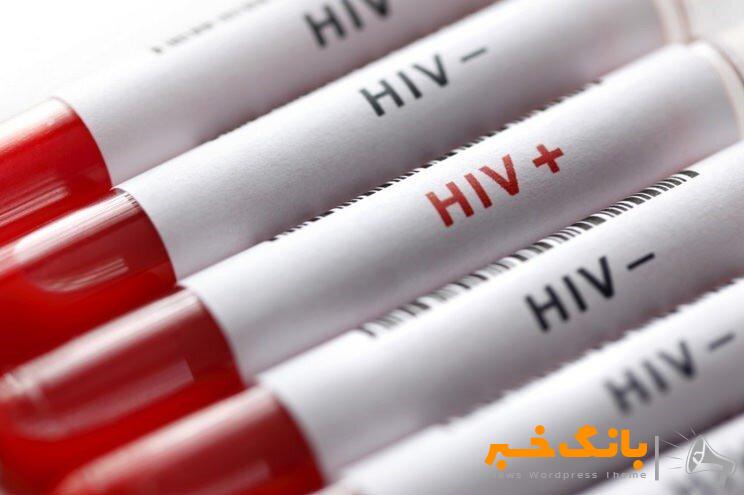 آخرین وضعیت HIV در کشور