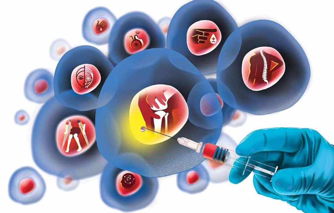 ایران در مسیر جهش استراتژیک روشهای نوین سلول درمانی بیماران صعب العلاج