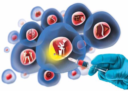 ایران در مسیر جهش استراتژیک روشهای نوین سلول درمانی بیماران صعب العلاج