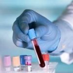 پیشگیری از بیماری‌های کلیوی با چکاپ منظم و مصرف صحیح مایعات امکان‌پذیر است