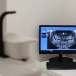 جرم‌گیری، راهی موثر برای پیشگیری از پوسیدگی و بیماری لثه